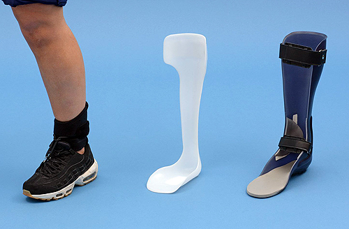 orthotic insoles nhs
