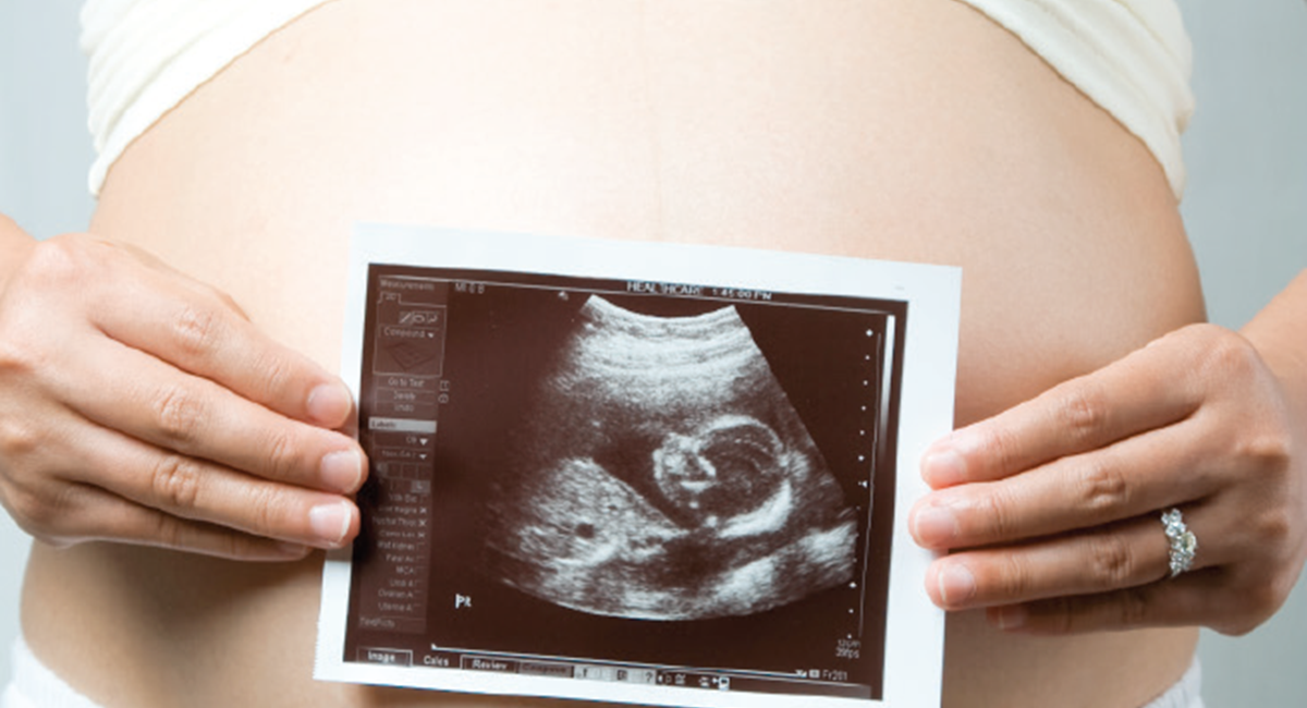 Photo image of a scan image of the baby placed over a pregnant bump